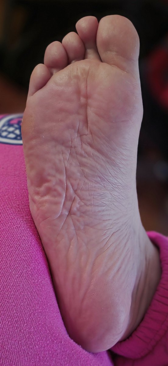 FeetPrincess867's tweet photo. Wrinkly sole anyone? 👣 https://t.co/GIMCRef4qo