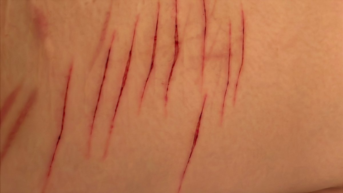 number_1_erm's tweet photo. ouuuughhh https://t.co/qQneTyjLnA