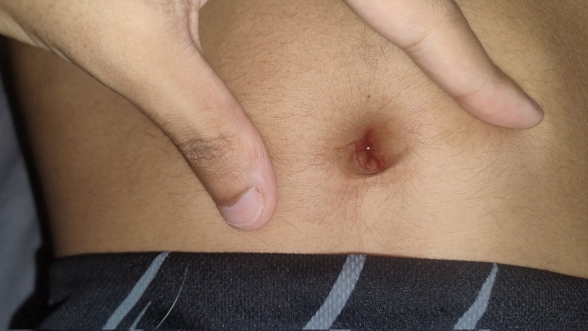 nav_el_br's tweet photo. #navel #navelplay #naveltorture #navelstab #needle #umbigo https://t.co/OxByPo0VLr