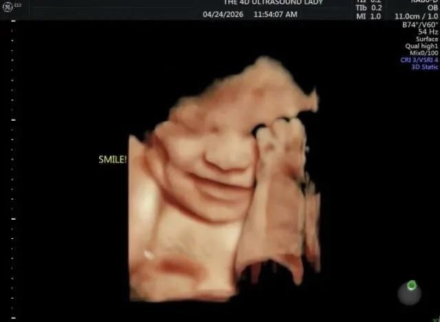 ReddCinema's tweet photo. Tell me again that this is a clump of cells. He/she is SMILING!!! https://t.co/OhT7Y5xYPt