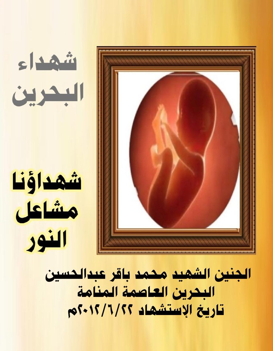 qaherathalmain's tweet photo. اليوم ذكرى إستشهاد  #الشهيد_محمد_باقر_عبدالحسين
#البحرين العاصمة #المنامة
تاريخ الإستشهاد ٢٠١٢/٦/٢٢
استشهد وهو جنين بعد استهداف نظام الحكم منزلهم والأحياء السكنية والمتظاهرين بالغازات السامة وفقضي شهيد بعد استنشاق والدته للغازات السامة وهي حامل به وتسمم جسده 
#شهداؤنا_مشاعل_النور https://t.co/BoJAjduud8