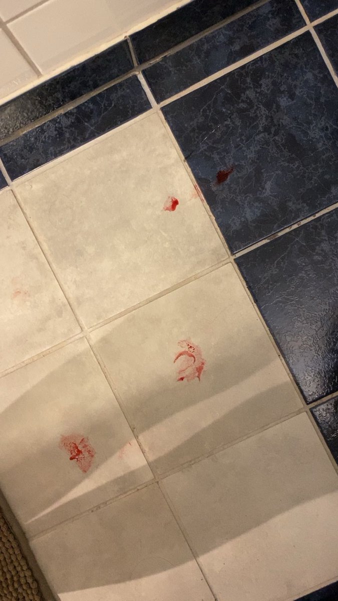 seiersfri's tweet photo. bonus!!! all the blood on the floor I had to wash away^^ https://t.co/7EwaXTgDEn