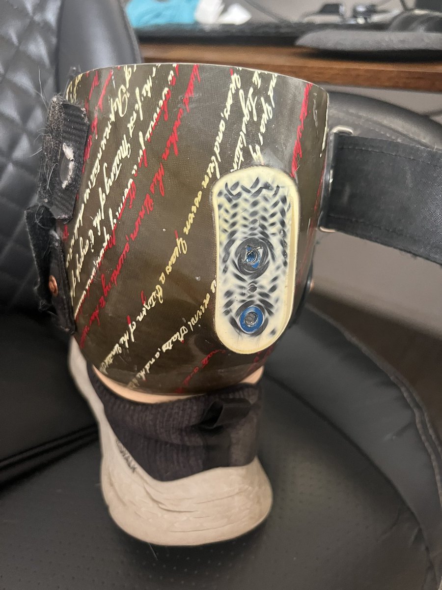 HeysoosChristo's tweet photo. Well shit.  This happened today.  Major prosthetic fail. https://t.co/l6vX34v6pa