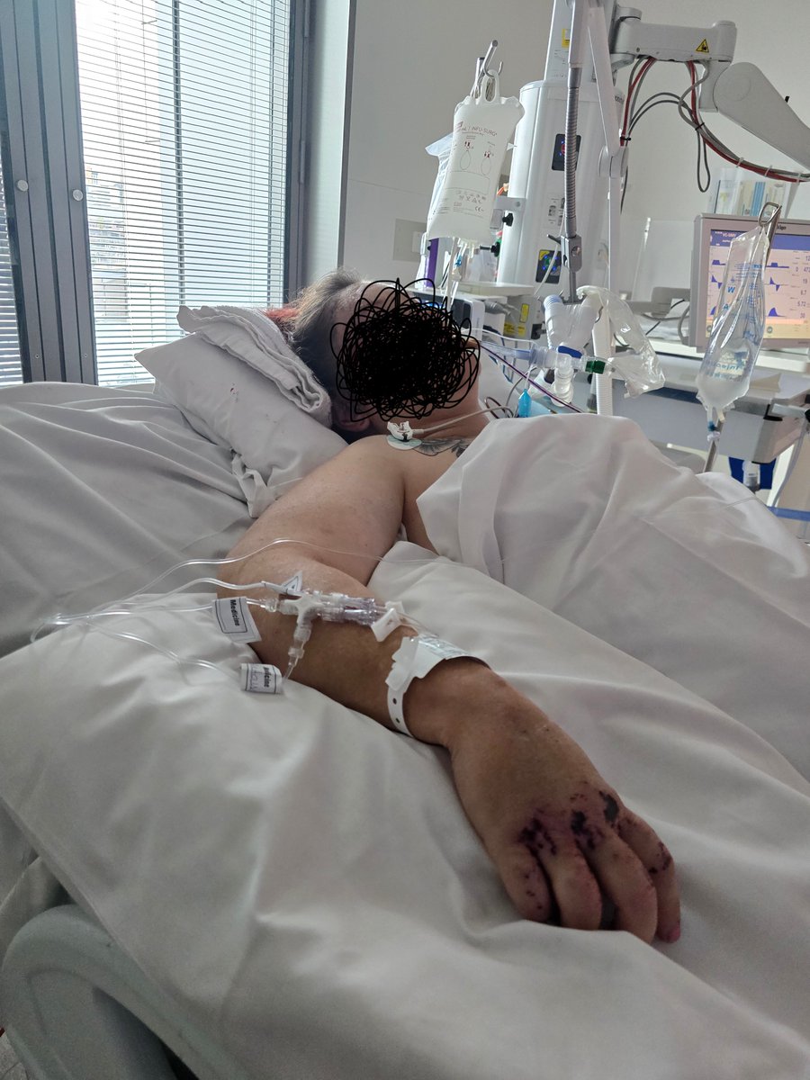 ObsidianNovalit's tweet photo. She looks like mum did.
I am so filled with rage and nowhere for it to go. 
I had my surgery two hours ago and I am here. Where is everyone. https://t.co/vQLBYhHafu