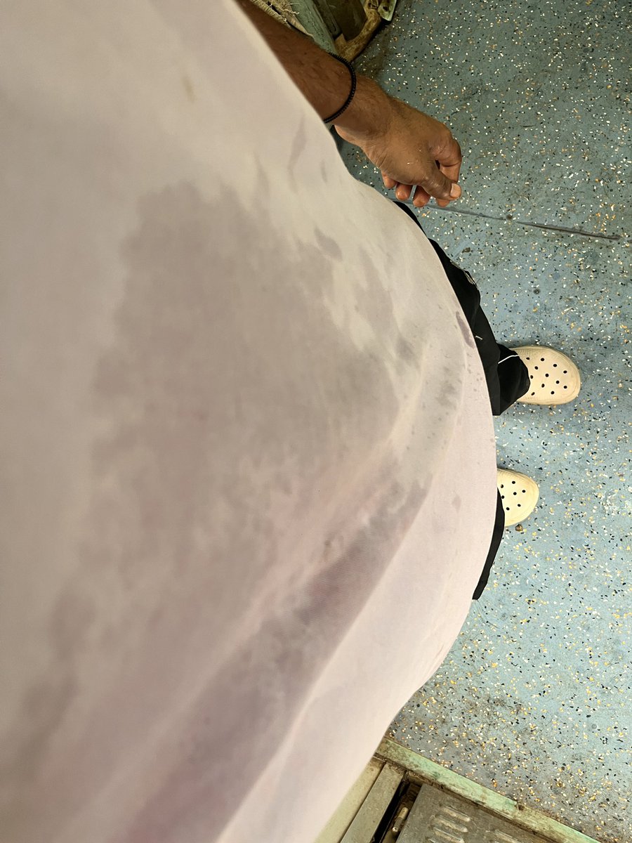 JayChandna's tweet photo. (T-18010, C-A2)

Worst 2AC travel experience. 
No charging point at my seat or nearby side berths. 

Water facility is poor—one tap isn’t working and my clothes got wet.

This journey has become a nightmare.

@AshwiniVaishnaw @RailMinIndia @srdcmkgp https://t.co/HrdLB9g1F3