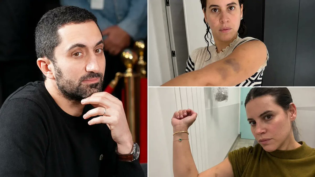 LeMediaEn442's tweet photo. Jimmy Mohamed accusé de violences par son épouse : Souailla Mohamed publie des photos d’hématomes https://t.co/HiSyMKkEIk

Souailla Mohamed affirme avoir subi “des violences de tous types” de la part de Jimmy Mohamed, ainsi que des infidélités. Elle dit également recevoir de nombreux appels et messages malveillants, qu’elle attribue à des femmes ayant eu une relation avec son mari.