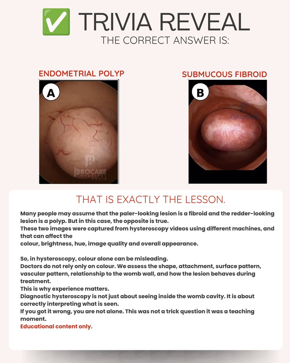 procarehehe's tweet photo. Hope you had fun playing along! 😊 Now, here is a response to our previous Health Trivia https://t.co/aS0JeRH2aV