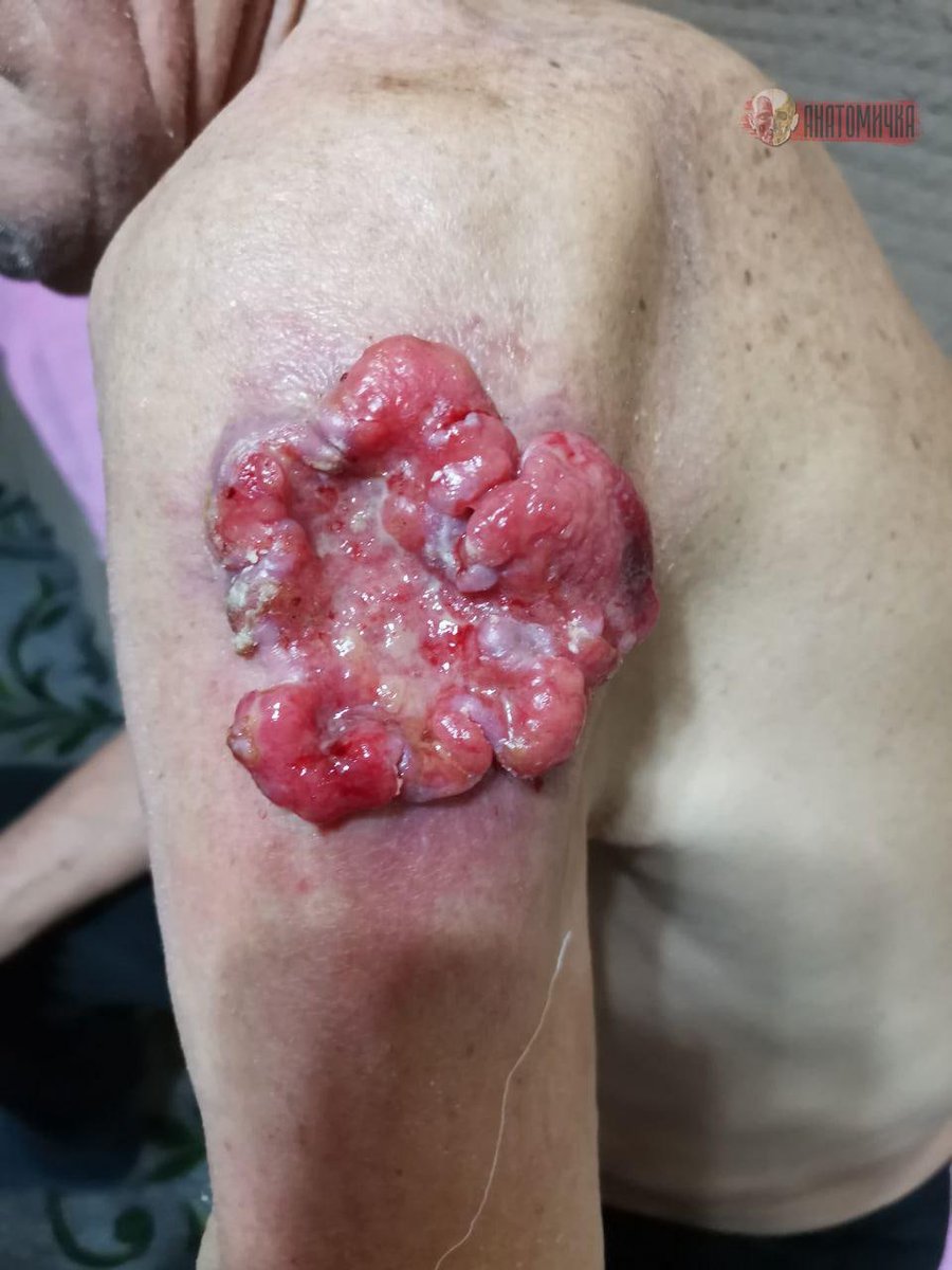 IhabFathiSulima's tweet photo. What is the diagnosis? https://t.co/c8yfXJG5Kf
