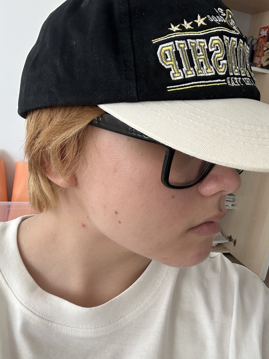 milkysmoker's tweet photo. do NOT wear caps. https://t.co/CLoQ0xcngw