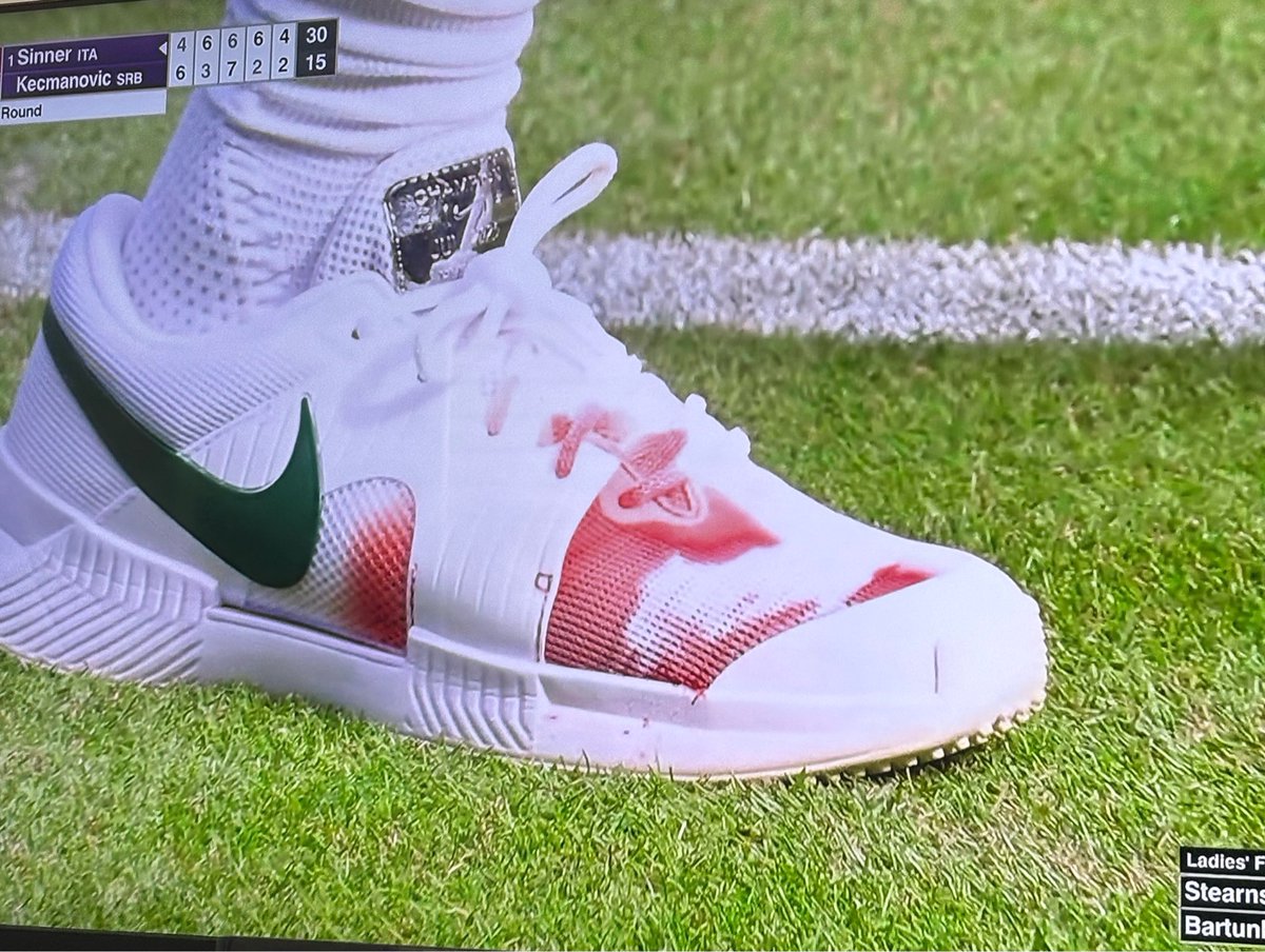 yoncesin's tweet photo. jannik did a toe fall off?? https://t.co/fn4KWJ0AbU