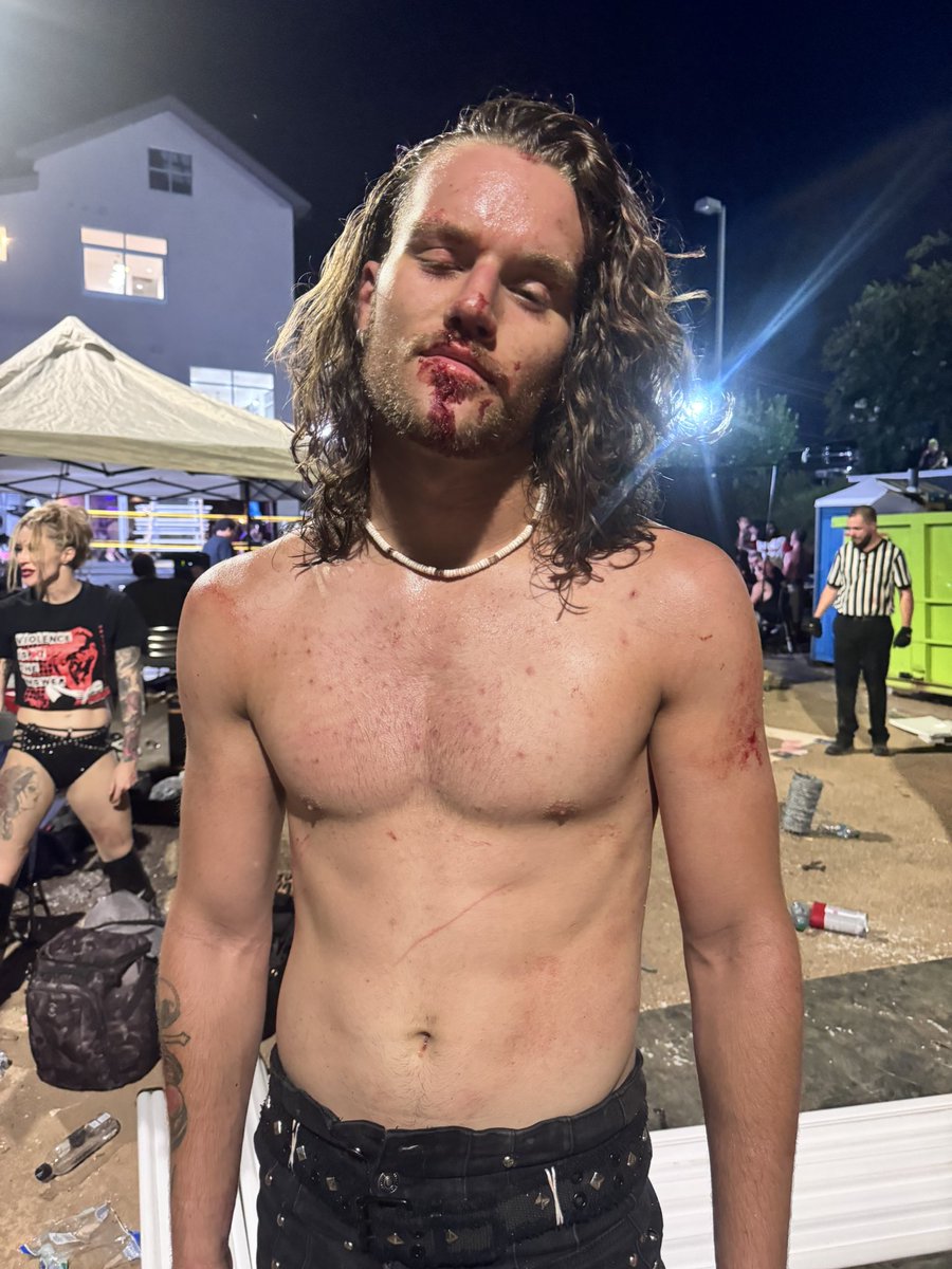 TheFamePierce's tweet photo. Bloody and still looking ✨Fameulous✨
#blood #WWE #AEW #TheFame #Wrestler #prowrestler #deathmatch https://t.co/WhxnTRB8ry