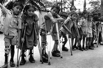 GerhardWan28792's tweet photo. @drtom878 @Kaos_Vs_Control Polio victims are individuals who contracted poliomyelitis, a viral disease that can cause paralysis, with many surviving but often facing long-term physical challenges. https://t.co/M4B5CUpgq3