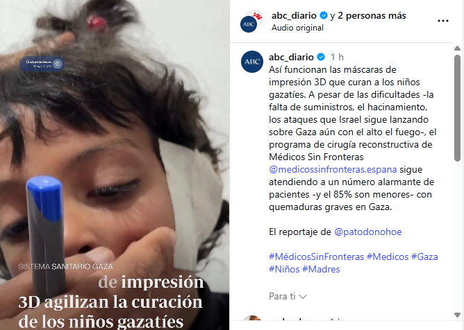 ACOM_es's tweet photo. Los niños gazatíes. 
Porque son los únicos niños del mundo. No hay niños en España. Ni en Hispanoamérica. Ni en toda África. 
Solo hay niños en Gaza. 
Y a pesar de haber recibido miles de millones en ayudas, no pueden hacer este tratamiento allí. ¿Sabéis por qué? Porque sus papás se lo gastaron en armas y misiles para asesinar a los niños de Israel. Mientras cometían crímenes horrendos contra las mamás israelíes y usaban a los niños gazatíes —sus propios hijos— como escudos humanos. 
Pero eso no te lo va a contar el @abc_es .