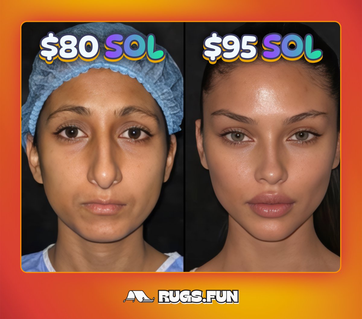 Rugsfun's tweet photo. @mert Solana needs a Turkish plastic surgery https://t.co/02P76zVtmm