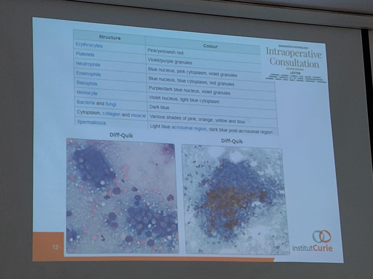 EfcsYoung's tweet photo. Now happening π£ #EFCSTutorial in π¬π·, bringing together cytology professionals to share, learn and strength collaboration and experience
#cytolovers #cytopath #cytology #cytopathworldwide https://t.co/qy9uwGj6gh
