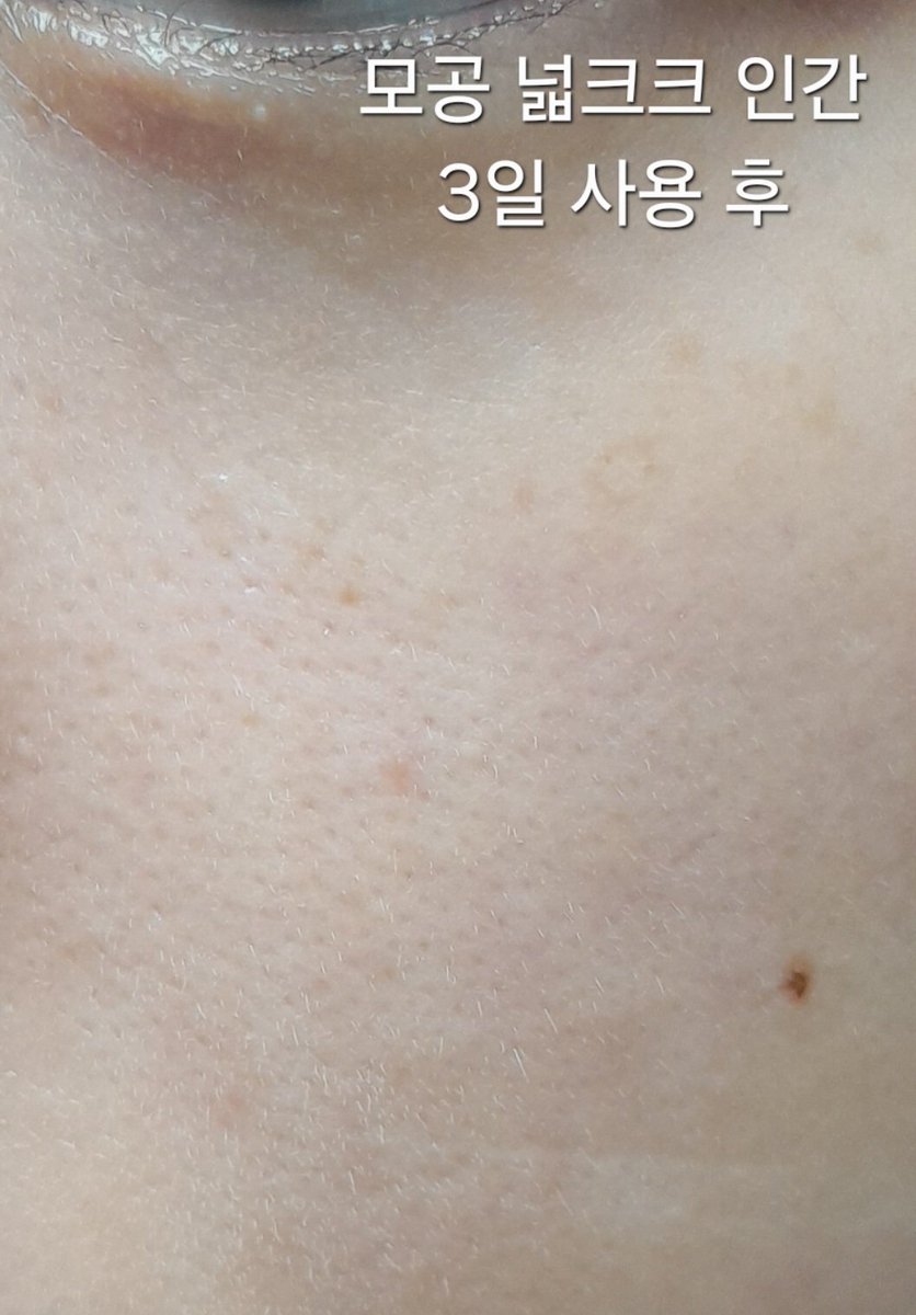 fufu18681's tweet photo. #광고 #RT이벤트 @innisfree_kr

​🎁 RT 추첨 3분께 
'이니스프리 레티놀 시카 모공 흔적 앰플 기획세트' 보내 드려요
당첨자 발표: 7/2목

재...크흠..재....재구매
재구매만 5번한 "그" 모공 앰플이 업그레이드 되어 돌아왔습니다
모공 관리 잘 하고싶다
>가성비로 이거 들여서 꾸준히 바르면 됨 https://t.co/AsTfqfGRBr