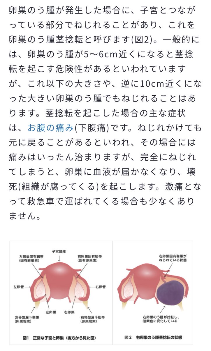 ArbitraryTrip's tweet photo. 女性の場合は卵巣捻転は
起こる可能性があります。

嚢腫などの影響によってなので
発症するのは20〜40代くらいが
多いようです

精巣捻転は『関連痛』として
お腹が痛い。という場合もありますので
気をつけましょう https://t.co/XVDftPVwEI
