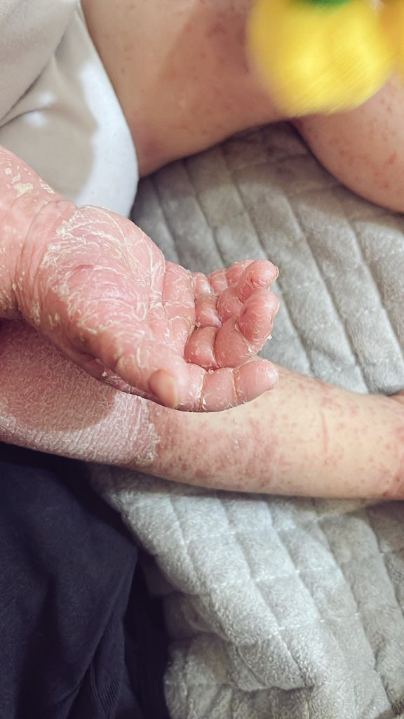 yousefQasem1998's tweet photo. NO DONATIONS FOR FIVE DAYS!! 
NO DONATIONS FOR FIVE DAYS!! 
NO DONATIONS FOR FIVE DAYS!! 
NO DONATIONS FOR FIVE DAYS!! 
NO DONATIONS FOR FIVE DAYS!! 
NO DONATIONS FOR FIVE DAYS!!
NO DONATIONS FOR FIVE DAYS!!
NO DONATIONS FOR FIVE DAYS!!

REPOST😓💔😭😱

https://t.co/45Gj0rpJam https://t.co/o8cFYtRHSD
