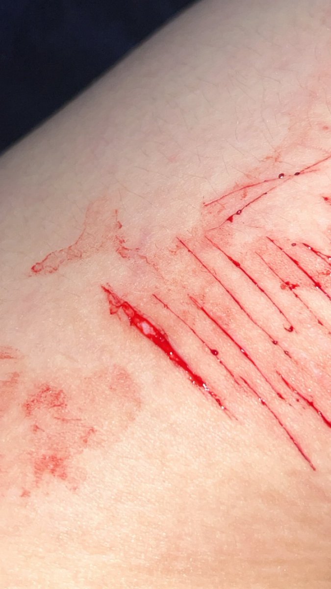 travisphelpssss's tweet photo. Multi swipe, deep styro?? 🥹
FAKE SFX MAKEUP FAKE BLOOD https://t.co/QYpUcMZ2Sg