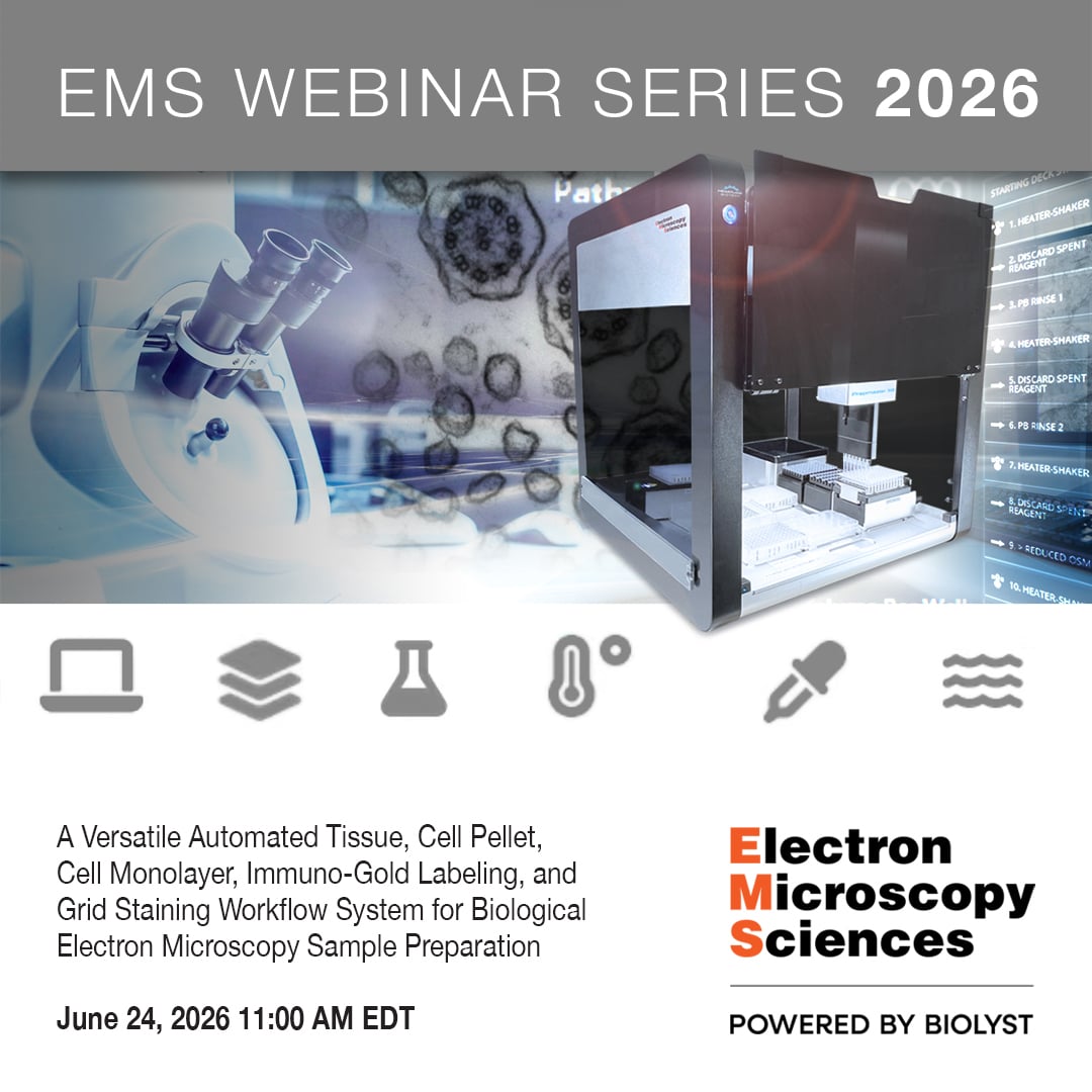 EMSDIASUM's tweet photo. This Wednesday...Our next webinar introduces the Prepmaster™ Automated Workflow System, delivering consistent, reproducible results across virtually any biological EM sample type. Free with registration. Details here: https://t.co/oqAhDLkYys

#EMShasit #automation #TEM https://t.co/Wr0hLl2I7H
