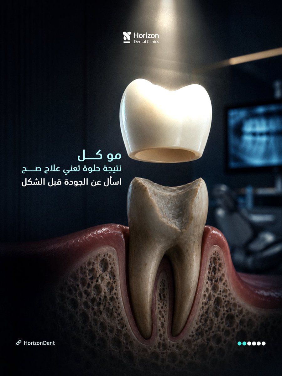 HorizonDent's tweet photo. كيف تختار العيادة الصح ⁉️

الجودة تبدأ من اختيارك 💎✨

#هورايزن_لطب_الأسنان #الرياض https://t.co/QlwpGy4OEA