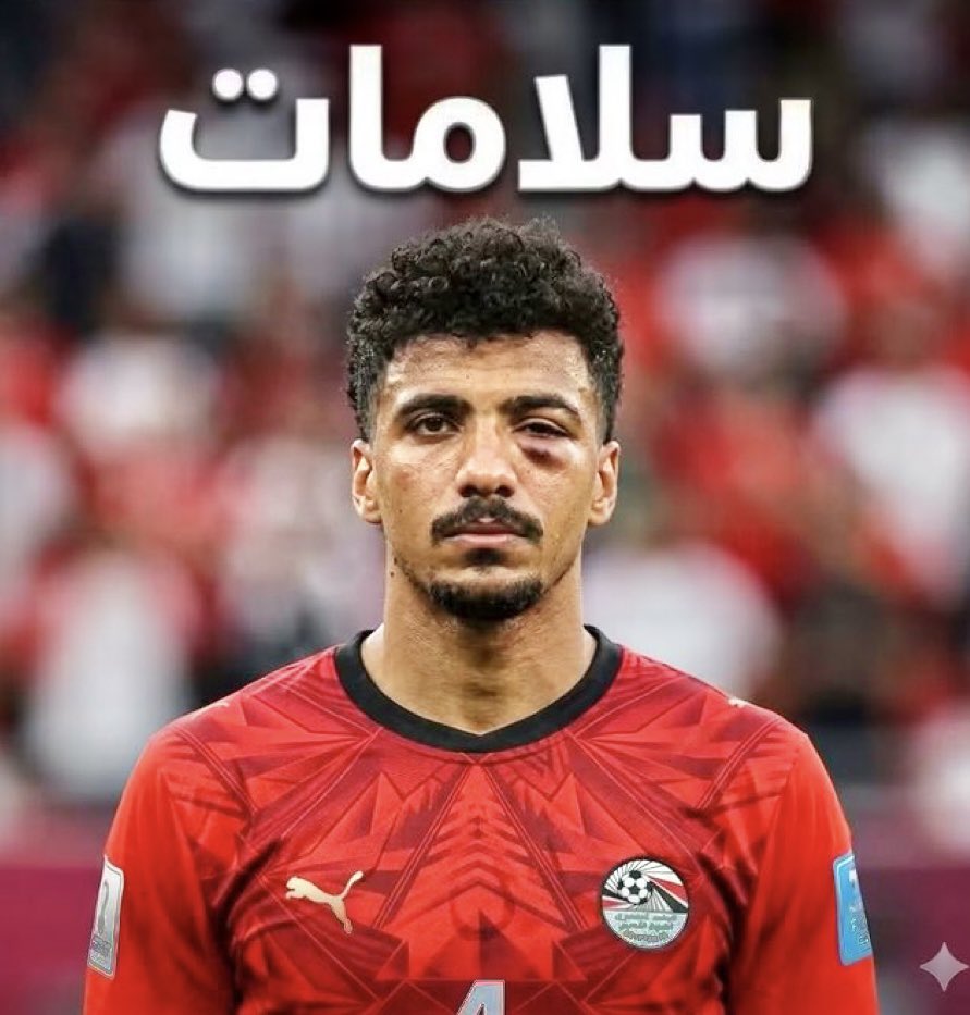 hussein59_iman's tweet photo. الف مليون لا بأس عليك. بأذن واحد احد ستلعب في مباراة ايران وتبلى بلاء حسنا فأنت وتد. قوي ابن مصر ضد الكسر. #مصر_نيوزيلندا https://t.co/yrxhldBfJP