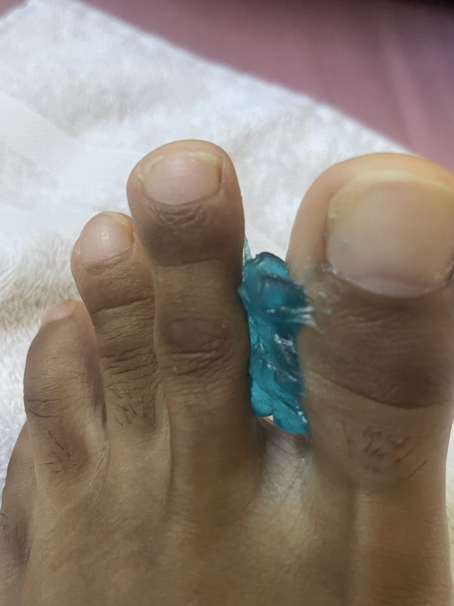 MacroxMayhem's tweet photo. Introduced the tiny intruder to my sweaty toes. Gave him a squeeze of a lifetime while the heat and sweat disintegrated his body. Think I’ll keep him there for the day…

#macro #macrofetish #feet #malefeet #giantfetish #sizedifference #sweatyfeet #malegiant https://t.co/kxtQsHaYEv