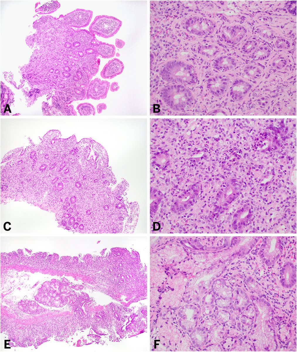 Human Pathology tweet media
