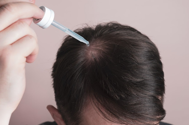 TheHairLossBlog's tweet photo. The Most Effective 5 Step Hair Loss Treatment Plan for Men and Women https://t.co/ZeAEYu3wuZ https://t.co/1LbKsI6aS6