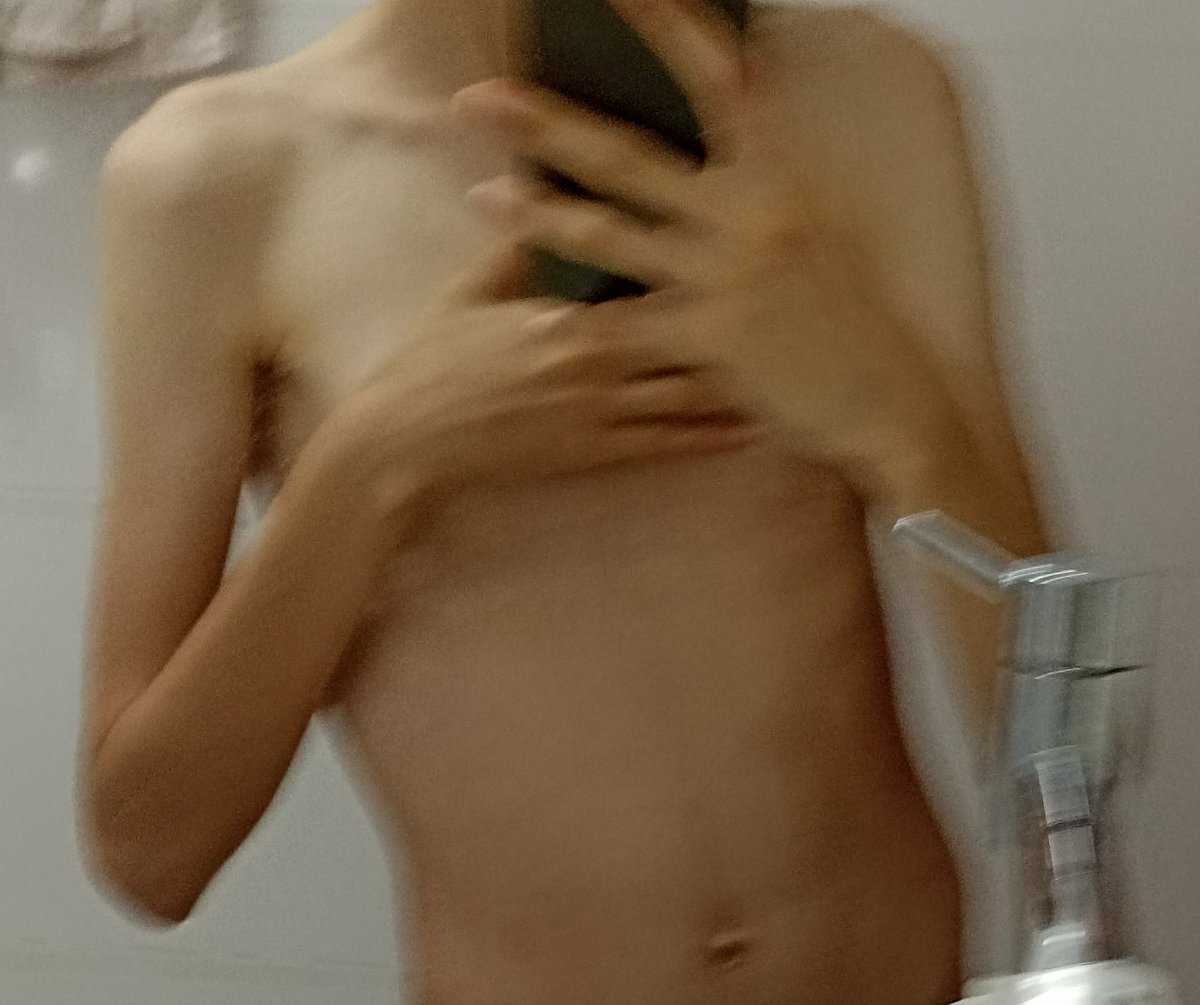 ednostrigger's tweet photo. último dia em casa antes da internação no Ambulim pra ganhar peso
33kg
1,57 https://t.co/APui8NTFC9