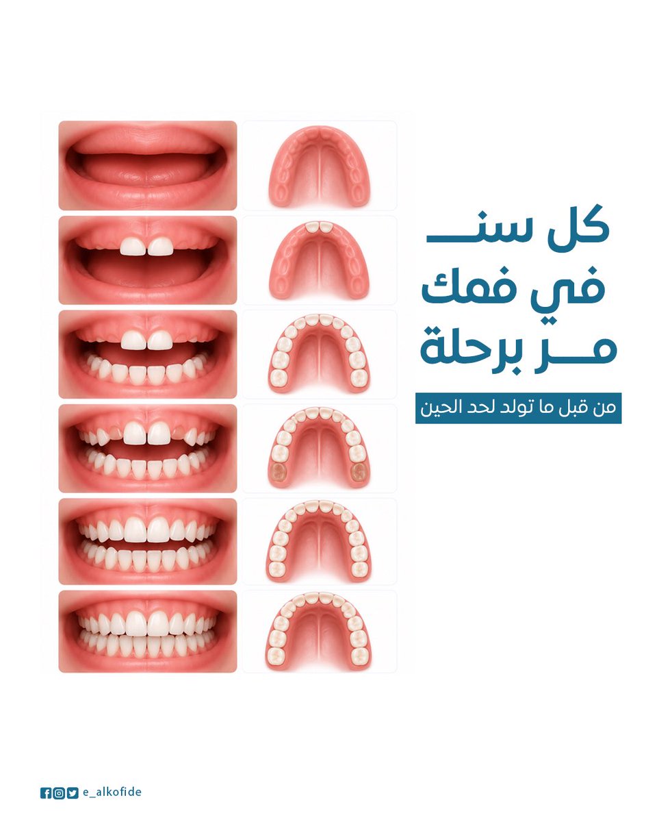 e_alkofide's tweet photo. #ثريد 
كل سن في فمك مر برحلة ما تعرفها 🦷
Thread يشرح كل مرحلة
واللي المفروض تعرفه في كل عمر👌

#اسنان #السعودية #دكتورة_ايمان_القفيدي https://t.co/i9lN9rBDPM