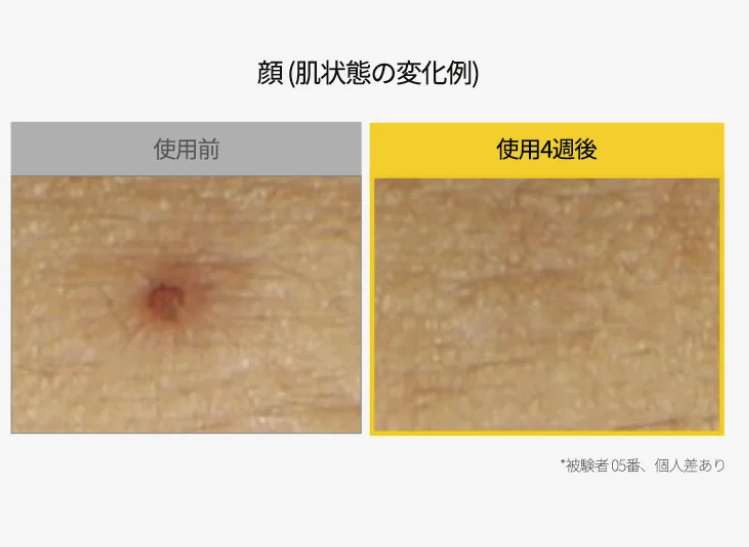 sona_biyou's tweet photo. ダルバのカスタムクリームってあんまり目立ってないけど効果えぐいよね？？？？ ニキビも消してくれるし、ツヤハリだしてくれるってこんな万能クリームないよ🥺🥹 https://t.co/Yrf67JubCP