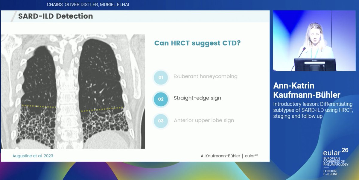 debaditya_roy's tweet photo. 💡Key HRCT clues suggesting #CTDILD highlighted at #EULAR2026:
🔹 Anterior Upper Lobe Sign
🔹 Exuberant Honeycombing
🔹 Straight Edge Sign
🔹 Four Corners Sign
💡Also look out for extrapulmonary clues! https://t.co/OCSDoK0q8P