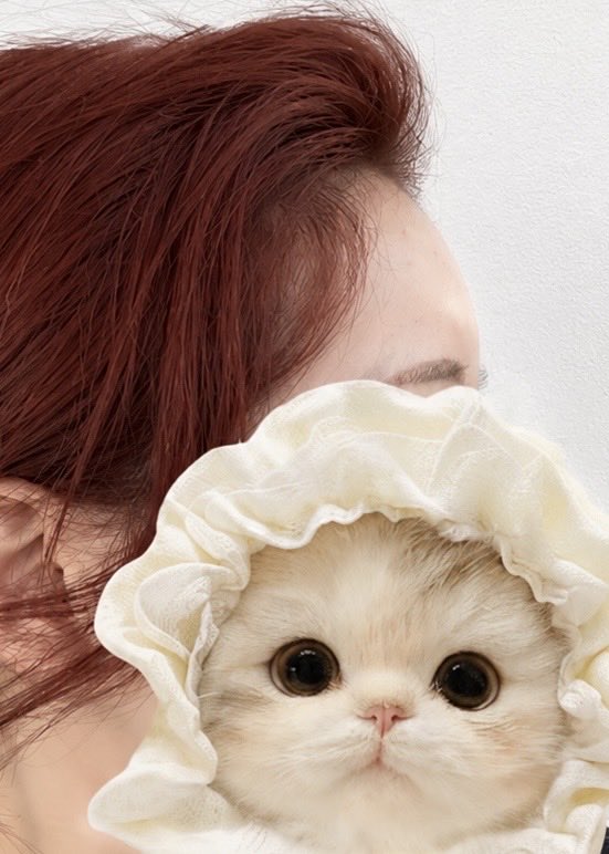 8Uu9n's tweet photo. ザビビ整形外科（@TheBBjp ）で額に脂肪移植をして2週間😻
まんまるなおでこになって大満足です☺️💕
今回は1回目の脂肪移植で、太ももからとってもらいました！
太ももは直後は筋肉痛のような痛みがありましたが、顔は特に痛みませんでした！
また1ヶ月レポします🙂‍↕️
←前
→2週間後 https://t.co/EH5eASbxVV