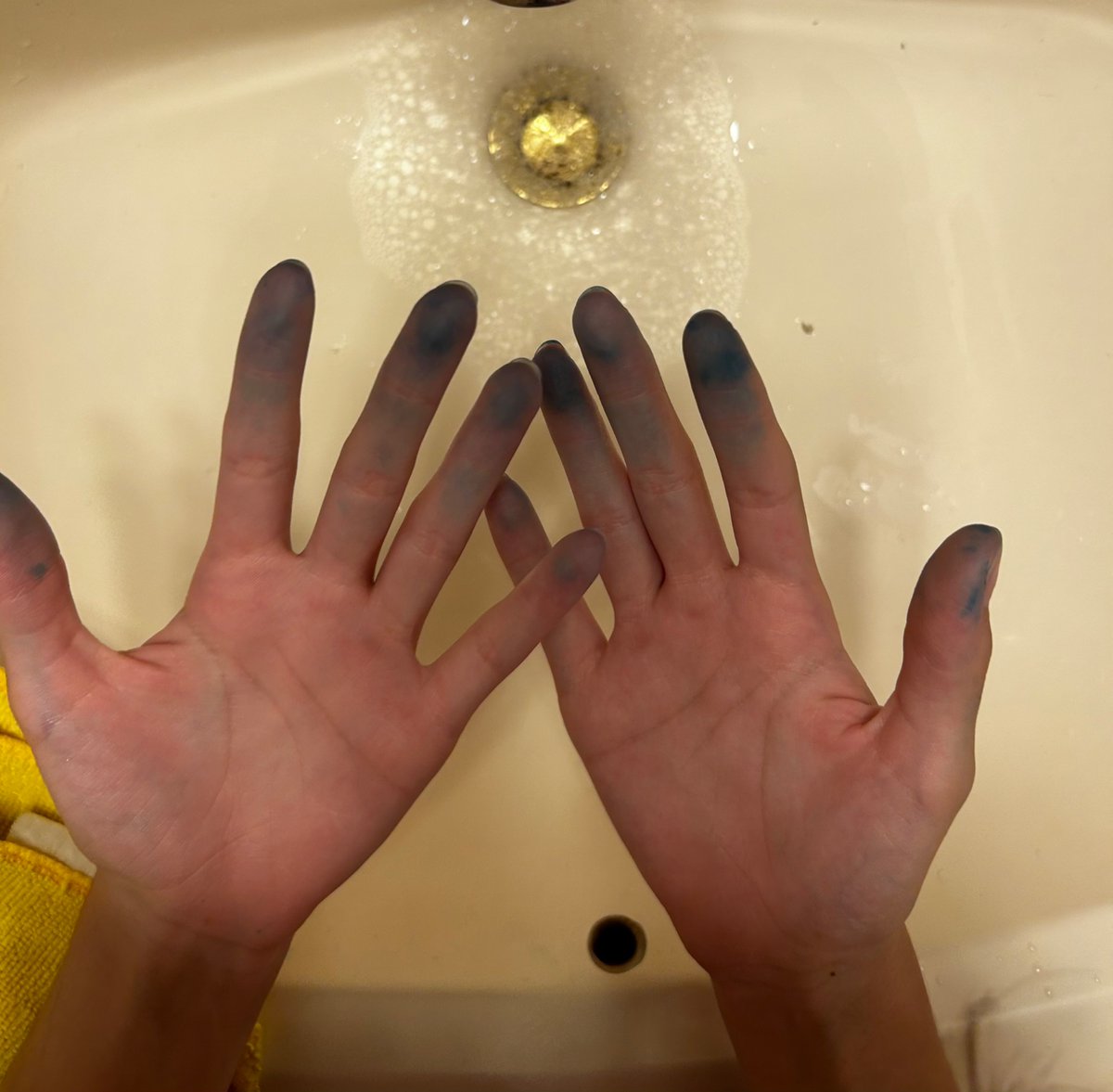 mayaxfedya's tweet photo. I used marker ink to dye my hair and it ended up going everywhere and now I’m turning blue 💔😢 https://t.co/Vom5NeYZW3