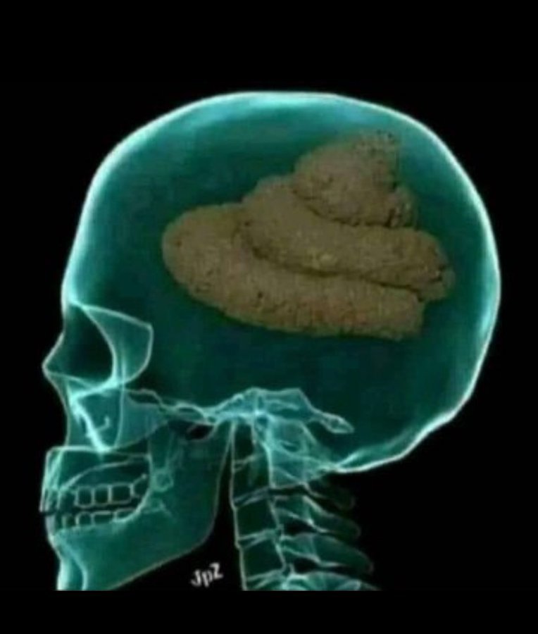 Itswell2023's tweet photo. @LegendaryJoe See your brain here https://t.co/U0i1RiH3qS