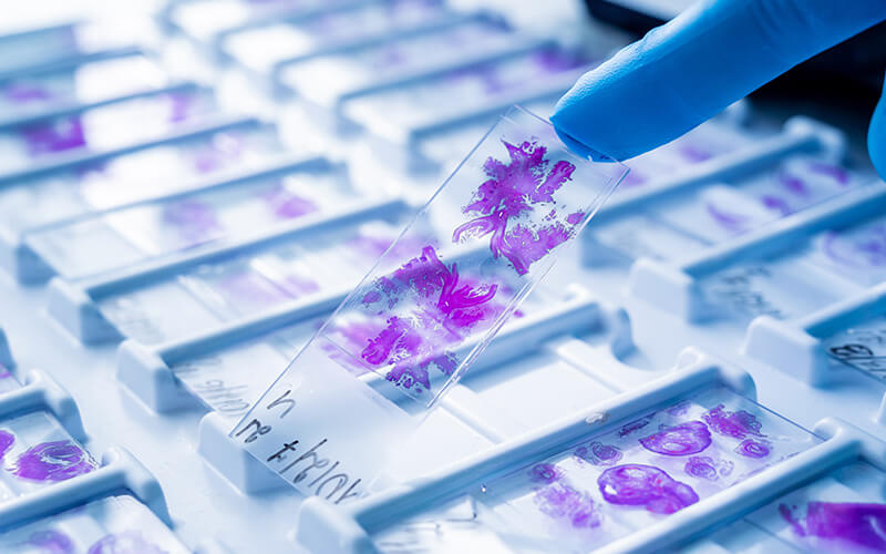 CreaBioarray's tweet photo. Access over 100,000+ ethically sourced, clinically annotated biospecimens — tissue blocks, tissue sections, FFPE pellets, TMAs, and biofluids. https://t.co/VH2U9ACay7 https://t.co/23YZxMW3Vb