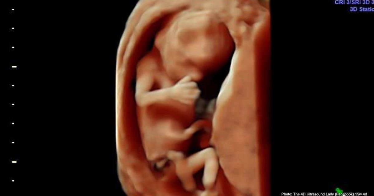 LiveActionNews's tweet photo. Gallup poll: American attitudes on abortion remain largely unchanged https://t.co/FSNDYrLGgK https://t.co/3mXlioN1uP
