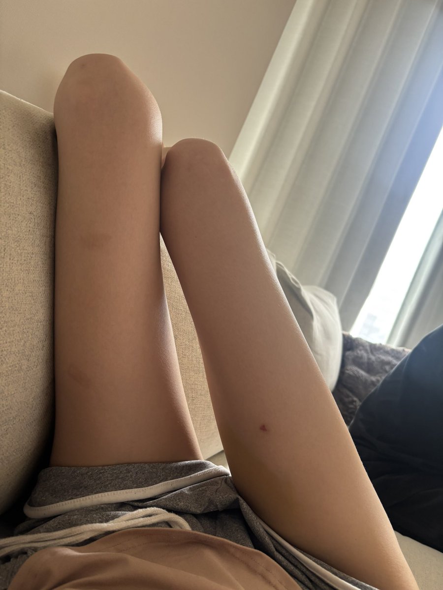 garigobu's tweet photo. 本物の細ももで嬉しい。無加工でこれ。
実物で見られたらもっと細！ってなるんだろうなーって思うとガチで嬉しな子 https://t.co/T5qg7cl4SH
