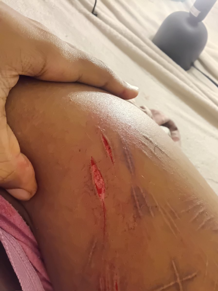 Mellzyyy_luvv's tweet photo. #cuttwt #slittwt #ouchietwt #styro #styrocut #sfx #makeup #fakeblood #sharm #sharmtwt #cut #sh ALL FAKE SFX MAKEUP NOT REAL ALL AI AND MAKEUP DONE BY PROFFESSIONALS https://t.co/OgEV8b3TdS