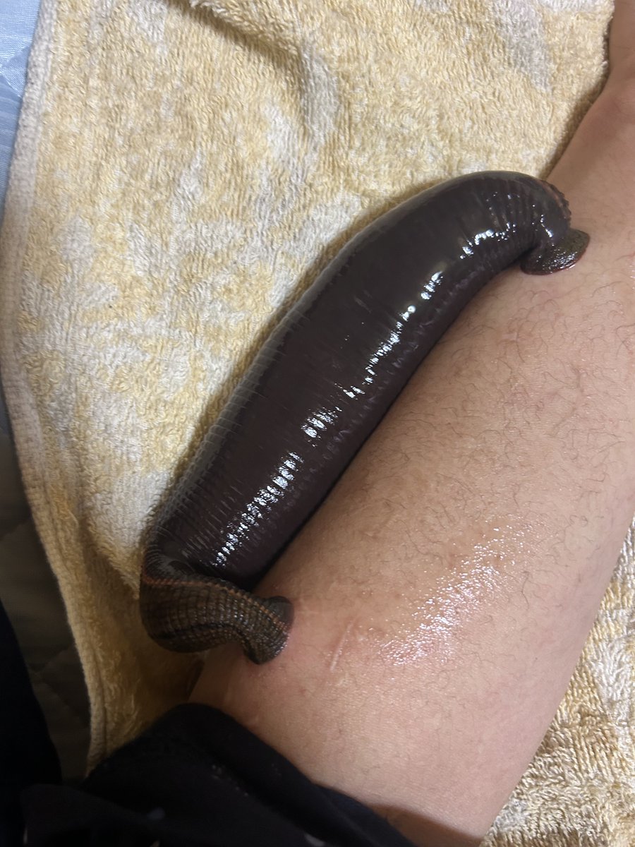 mesijimamusi's tweet photo. 2年ぶりに血を吸わせている。
やっぱりあんまり頻繁に吸わせない方が長生きする。 https://t.co/SPPNOWDt6T