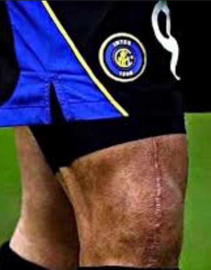 QWho's tweet photo. @pipiru22 @SelecaoTalk Smash Mbappe's knee with a hammer then see how he does. https://t.co/yj8XlVljgf