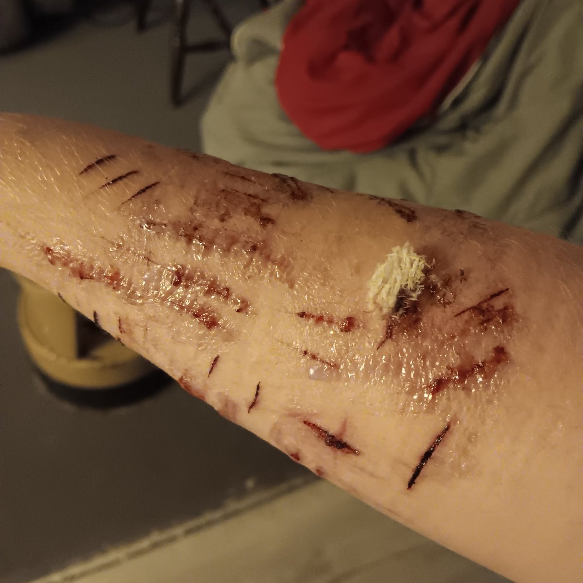 oh_gr2's tweet photo. Hospital fucked me UP dude, never get help it doesn't ever get better
#shtwt #shedtwt https://t.co/7PNVyCqb4e