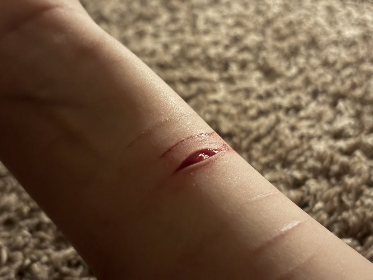 coquetteuh's tweet photo. relapse. deepest ive ever gone- dont mind the noise i was shovked #sh #goretwt #shed #cut #fakesfx https://t.co/lKSx0J7SeR