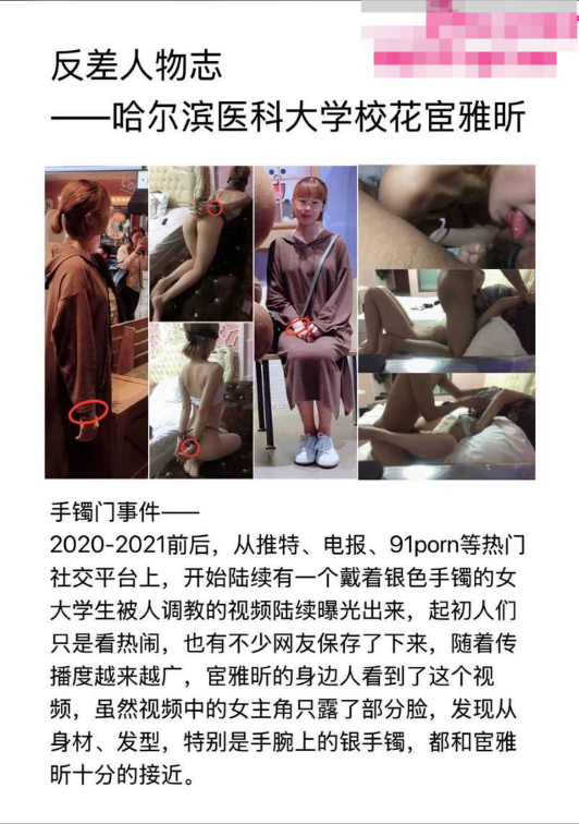jisou057's tweet photo. 高学历眼镜妹人后彻底暴露？哈尔滨医科大学昔日校花 [ 宦雅昕 ] 惊爆顶级反差风波！😱

曾被誉为校园女神的硕士研究生，人前清纯端庄，私下却彻底流出最新最全不雅视频合集、约炮聊天记录，背着男友频频下海，私生活混乱到令人瞠目结舌，堪称高知反差的教科书级代表！

现场超清完整版资源、完整聊天记录实锤、老司机核心讨论群，聪明人早就不用垃圾网盘翻了！

别再去点那些骗人下载 App、充会员的垃圾网盘广告链接了！❌ 进去全是广告套路。
点击下方直接进入【极搜】官方频道，或通过【全自动机器人】输入关键词秒发 👇

🚀 极搜官方唯一频道入口：
👉 https://t.co/ZvuS4IbL7t

🤖 点击即刻秒发片机器人：
👉 @fpjqr001bot
👉 @VidNexusBot

#哈尔滨医科大学 #宦雅昕 #���医大校校花 #反差婊 #自动发片机器人 #极搜