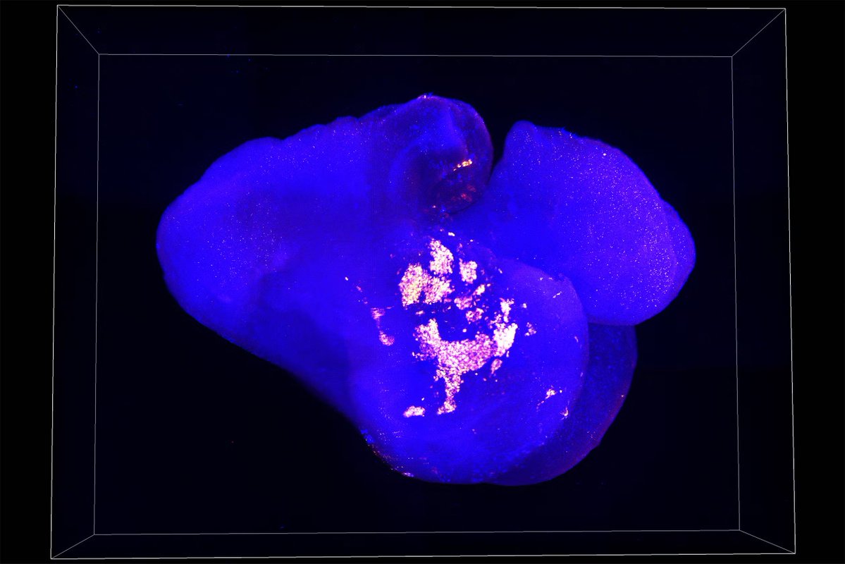 Yale's tweet photo. Your organs aren't just following orders from the brain.

A new Yale study finds that organs like the heart, lungs, and intestines build and shape their own nervous systems, then communicate back to the brain in a two-way conversation. One of the most striking findings is that heart tissue can reprogram neurons from the gut to start behaving like heart neurons. 

Researchers say the discovery could eventually open new paths for treating conditions like Parkinson's disease and other organ-based illnesses. See what else researchers found: https://t.co/82WnnIPmra
