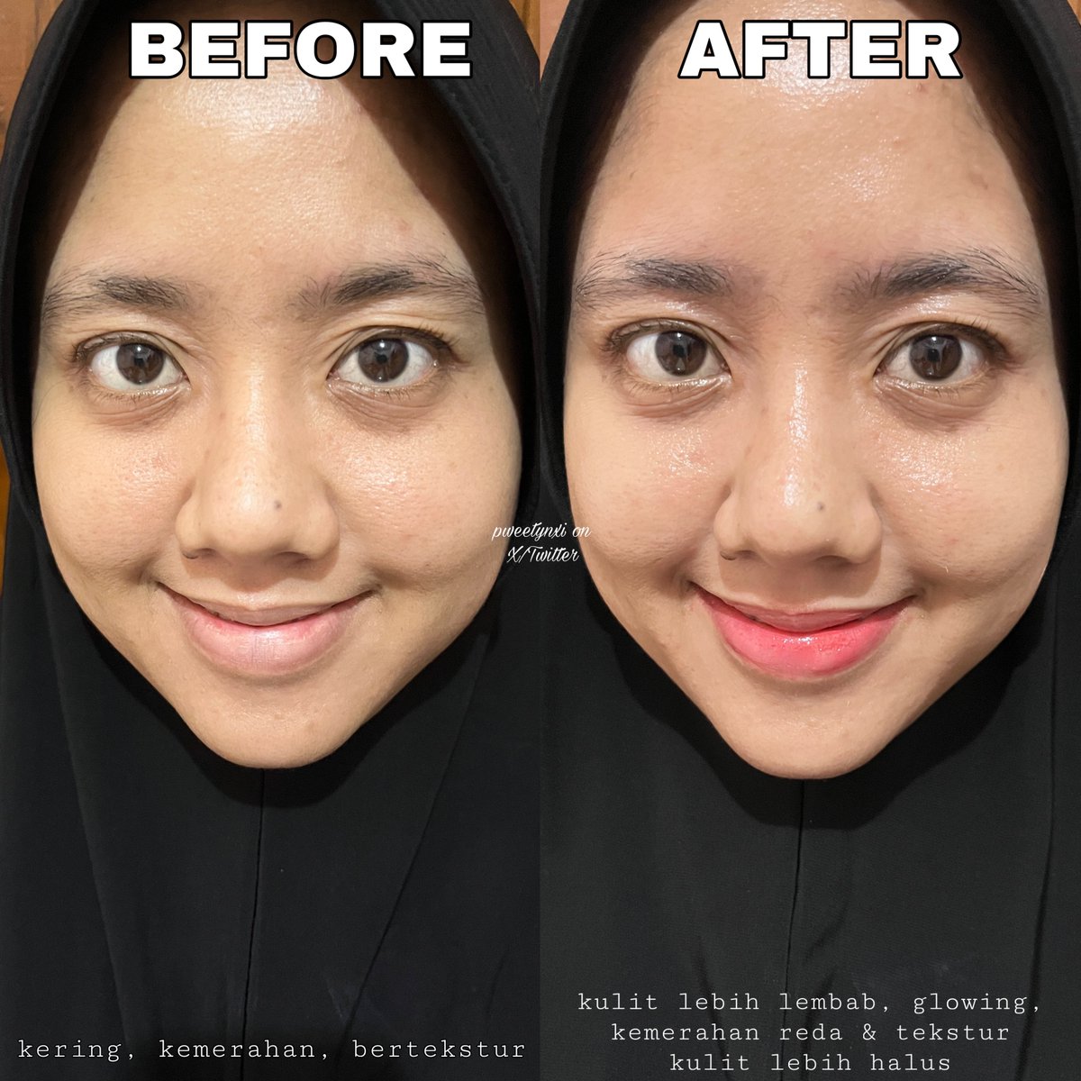 pweetynxi's tweet photo. Moisturizer se-GONG ini cuma 50ribuan?! 😧

Teksturnya mengingatkanku pada moist viral yang diboycott itu🥺
Iseng pake krim ini buat overnight mask dan hasilnya omgg 😍❤️ https://t.co/PxzKnPI9kU