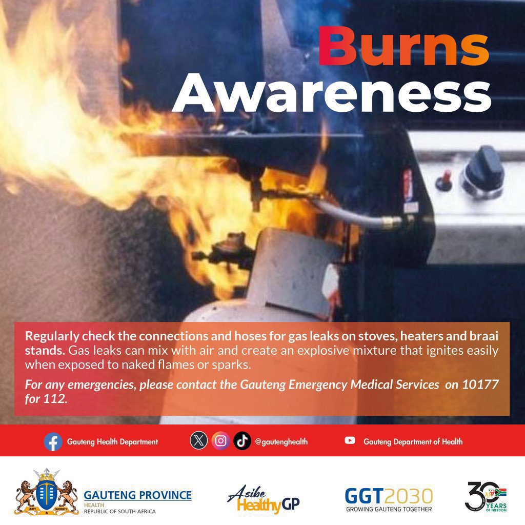 GautengHealth's tweet photo. As we experience cold temperatures in Gauteng let's also remember to conduct regular checks of our electrical connections, hoses for gas leaks, heaters, stoves, and braai stands. #AsibeHealthyGP #BurnsAwareness https://t.co/j1bOZELD4j