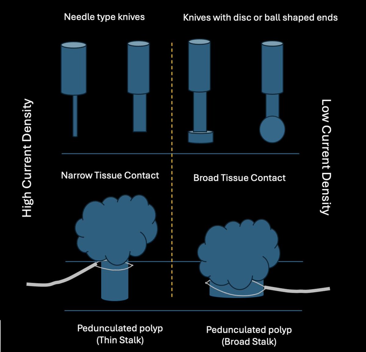FrontGastro_BMJ's tweet photo. 🚀 BSG EndoBridge Series (1/15): Diathermy Demystified

Most endoscopists can select a generator setting, but how many truly understand why it works?

📢 The first article in our 15-part BSG EndoBridge Special Issue explores the principles of diathermy that underpin everyday and advanced endoscopy.

🔗 https://t.co/ZGORnAKUfa

⚡ Why identical settings can produce different tissue effects
⚡ Cut vs coagulation: what's really happening?
⚡ The importance of voltage, impedance & current density
⚡ How saline immersion changes electrosurgical behaviour
⚡ Practical lessons for EMR, ESD, ERCP & third-space endoscopy

Whether you're performing a polypectomy or an ESD, understanding the physics behind electrosurgery can improve precision and reduce complications.

📖 All EndoBridge articles are fully Open Access.

#BSGEndoBridge #FrontlineGastroenterology #Endoscopy #EMR #ESD #ERCP #MedEd

@PhilSmithIsBack @OTavabie @dr_aditi_kumar @TrevorTabone @eathar_s @IrenePerezMD @KGananandan @zare_benjamin @medicalreg @dtleiberman @BASLedu @BSGtrainees @WorldGastroOrg @ulstergastro @SEEDendoscopia @EASLedu @AmCollegeGastro @Aegastro @SAGES_updates @WAGE_media @my_UEG @amergastroassn @NASPGHAN @UHSEndoscopy @ESGE_news @amergastroassn @BritSocGastro @ASGEendoscopy @EndoCollabcom @JAG_Endoscopy @SimonMEverett @gastro3570 @drkeithsiau @DrOmerAhmad @Dunnepdj @shraddha_gulati @CardiffGastro @DrBuHayee @poodocnisha @Sharm_Sub