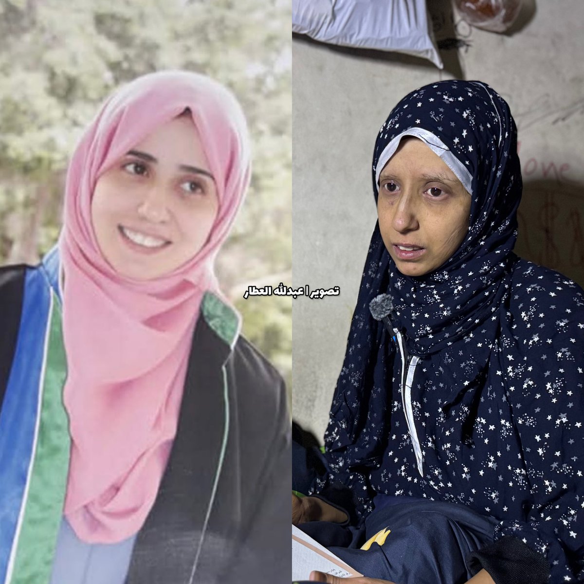 abdallahatar's tweet photo. الباحثة خلود أبو سهمود، الحاصلة على الماجستير والدكتوراه والحافظة لكتاب الله، تواجه مرض السرطان بينما تعيش نازحةً مع 10 أفراد من عائلتها تحت درج مدرسة في خان يونس. تنتظر فرصة للعلاج بالخارج بعد أن اجتمع عليها المرض والنزوح والحرمان.

للتواصل مع زوج خلود | +972 59-7488772 https://t.co/VDp4F6YCyK